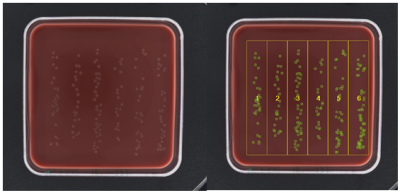 Serum Bactericidal Assay Sba Synbiosis