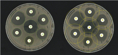 Antibiotic Susceptibility Testing (AST) - Synbiosis